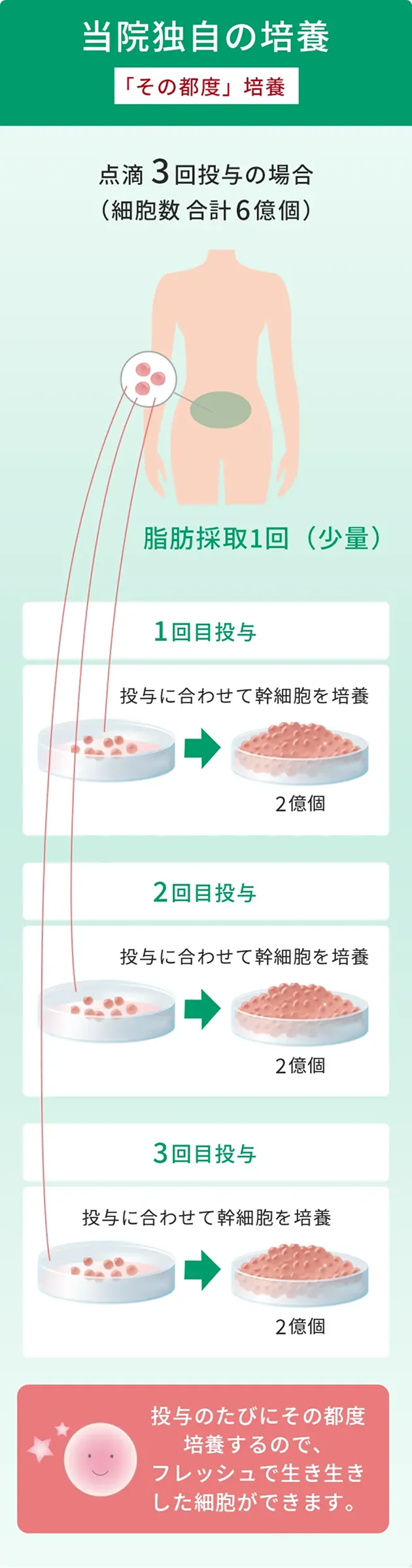 当院の独自の培養「その都度培養」のイラスト解説