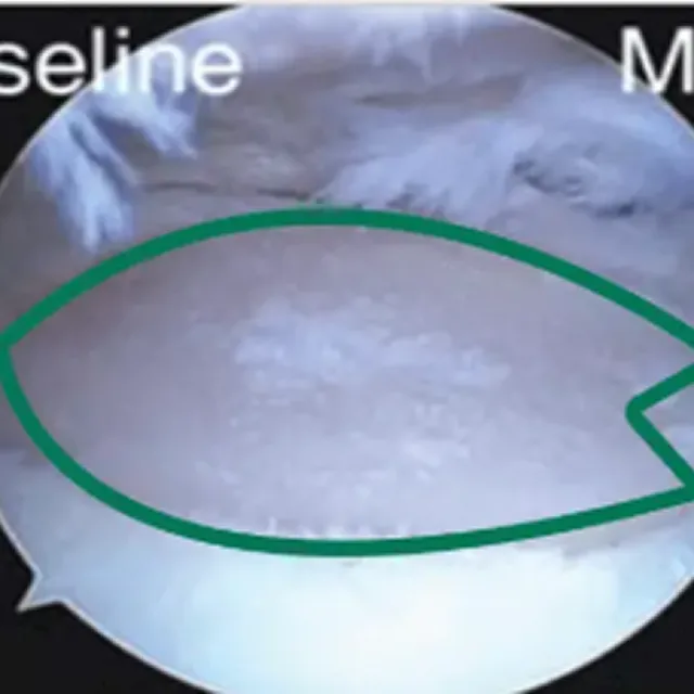 一般的な培養の幹細胞投与前