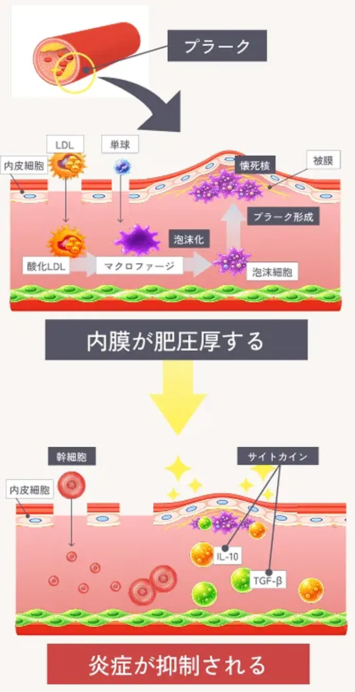 炎症抑制作用の解説イラスト 内膜が肥圧厚する 炎症が抑制される