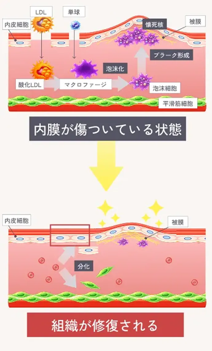 組織修復作用の解説イラスト 内膜が傷ついている状態 組織が修復される