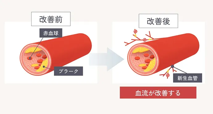 血管新生（血流改善）作用の解説イラスト 改善前と改善後