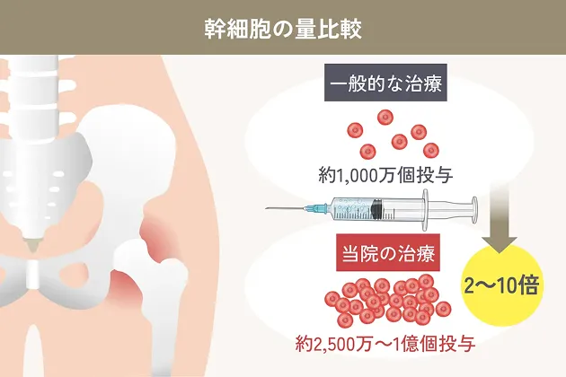 幹細胞の量比較の解説イラスト