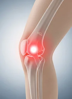 膝の内側の痛みのイメージ画像