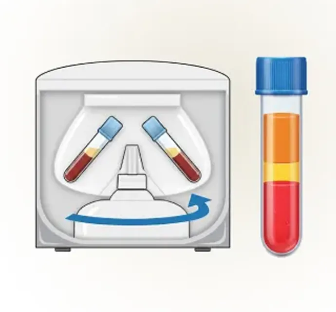ステップ2 遠心分離し血漿成分を抽出