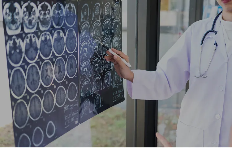 脳卒中の再生医療(脳梗塞･脳出血)・幹細胞治療