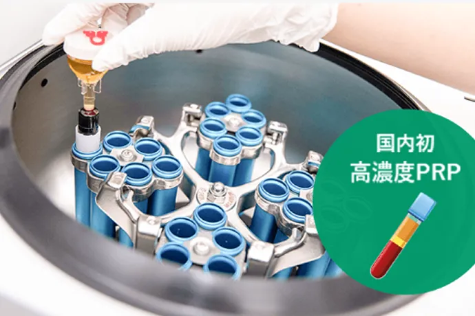 高濃度PRPを使用している様子