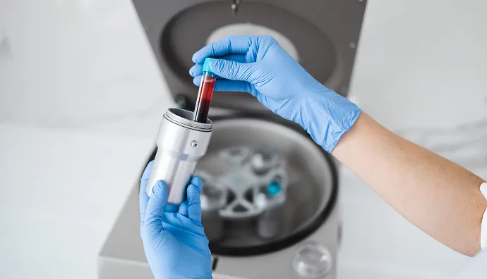 高品質なPRPのイメージ画像