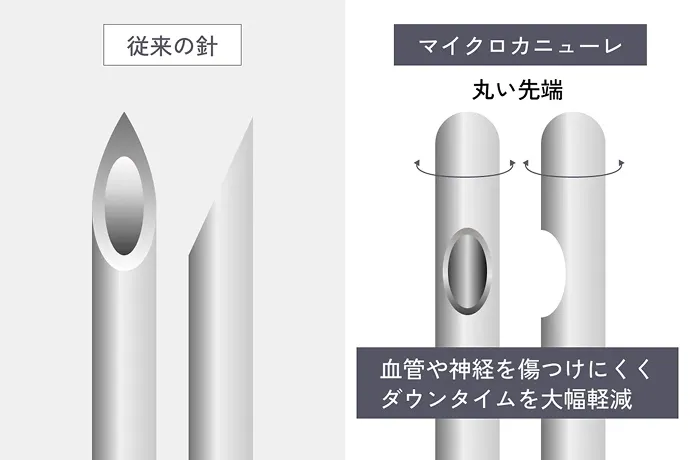 従来の針とマイクロニューカレの図解 丸い先端 血管や神経を傷つけにくくダウンタイムを大幅軽減