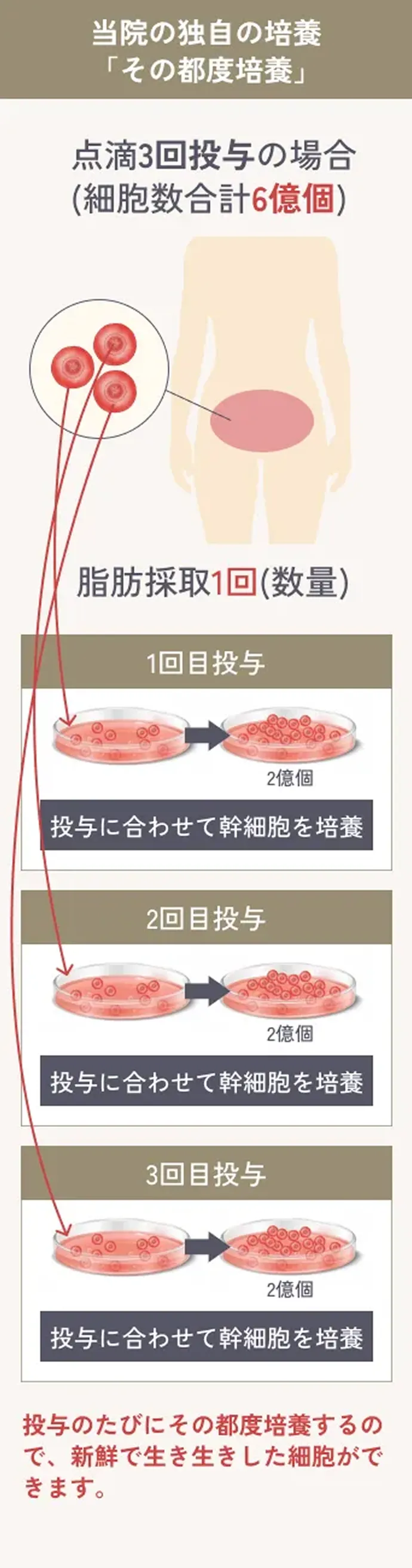 当院の独自の培養「その都度培養」点滴3回投与の場合(細胞数合計6億個) 脂肪採取1回(数量) 1回目投与～3回目投与のイラスト解説 投与のたびにその都度培養するので、新鮮で生き生きした細胞ができます。