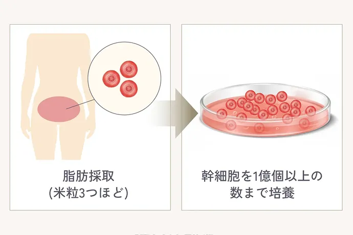 脂肪死守(米粒3つほど)から幹細胞を1億個以上の数まで培養