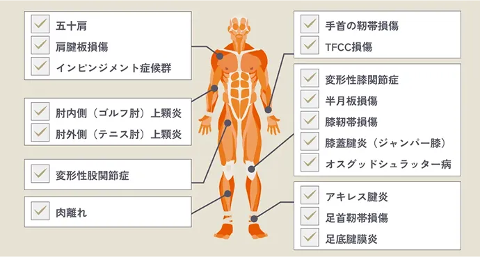 PRP療法が適応となる疾患の具体例を示したイラスト