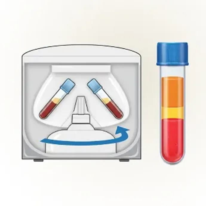 治療の2ステップ目 採血した血液を遠心分離し、血漿成分を抽出します
