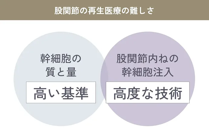 幹細胞の質と量 高い基準 股関節内の幹細胞注入 高度な技術