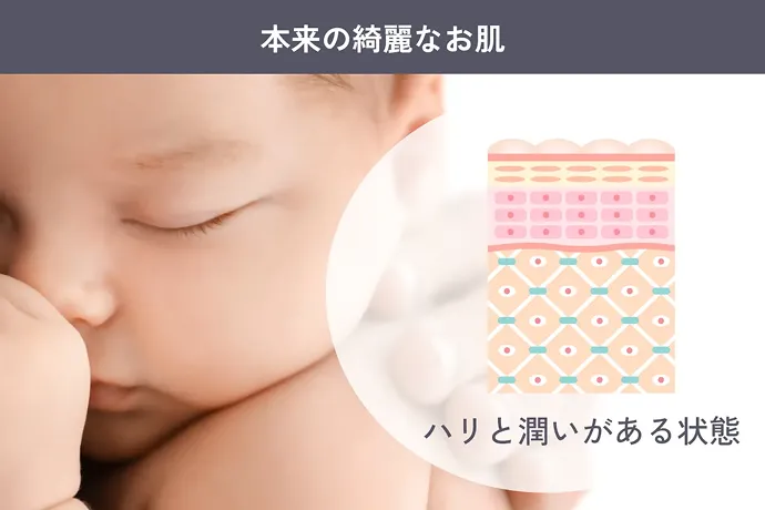 本来のキレイなお肌 ハリと潤いがある状態