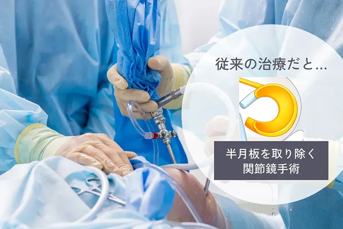 従来の関節鏡手術のイメージ画像