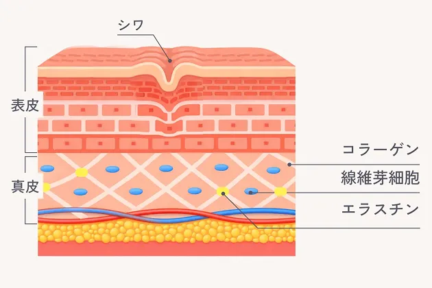 トラブルのあるお肌の図解