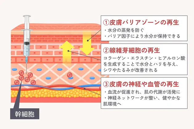 健康なお肌への再生を説明したイラスト図 ①皮膚バリアゾーンの再生 ・水分の蒸発を防ぐ ・バリア因子により水分が保持できる ②線維芽細胞の再生 コラーゲン・エラスチン・ヒアルロン酸を生成することで水分とハリを与え、シワやたるみが改善される ③皮膚の神経や血管の再生 ・血流が促進され、肌の代謝が活発に ・神経ネットワークが整い、健やかな肌環境へ