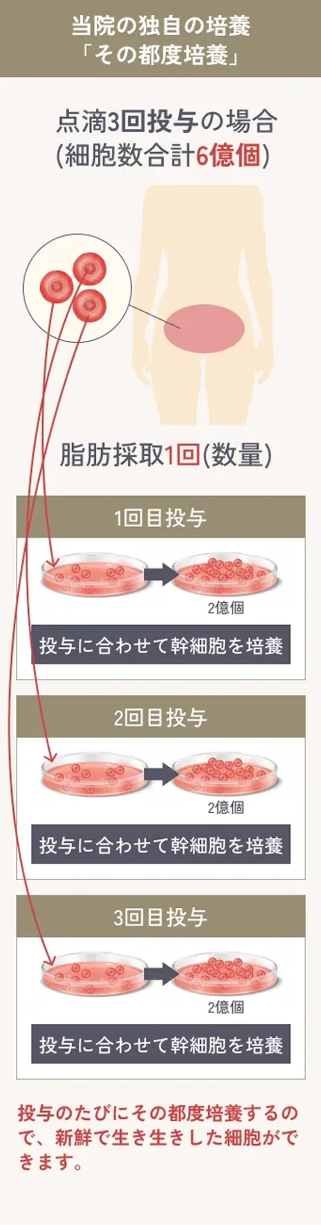 当院の独自の培養「その都度培養」の解説イラスト