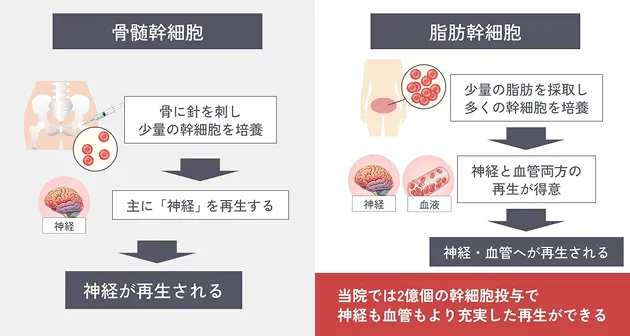 脂肪幹細胞と骨髄幹細胞の違いについての解説イラスト